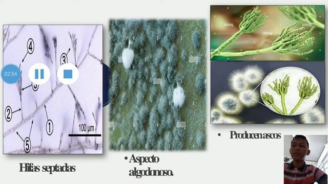 Penicillium Spp.