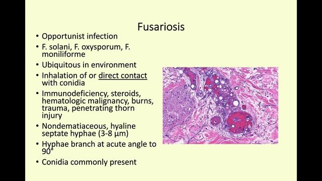 Intravascular Fungal Infections Phillip McKee, Vicktoryia Kazlouskaya, Kiko Com
