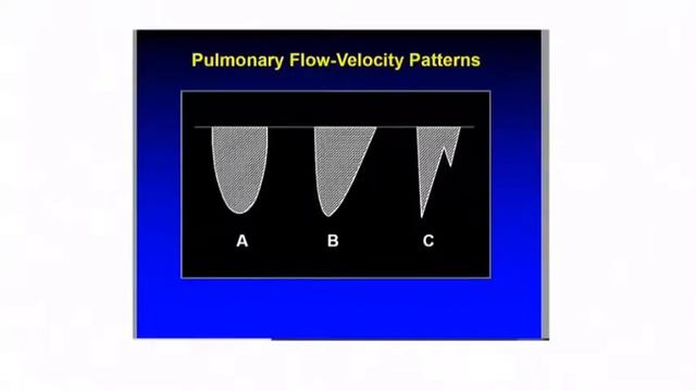 Echo assessment of Pulmonary Valve Dr Shaik Swalehin BUX смотреть онлайн
