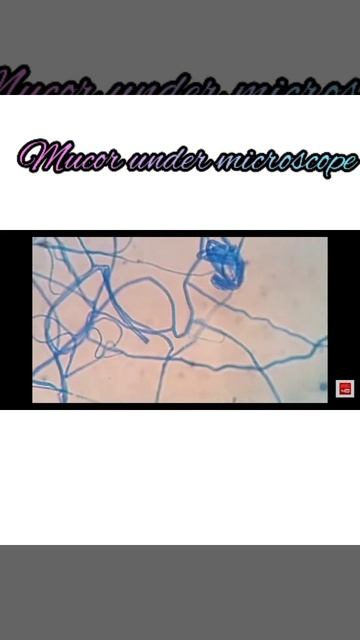 Mucor under microscope/fungi @cutie_girl_0023 смотреть онлайн