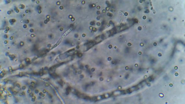 Trichoderma viride - ТРИХОДЕРМА ВЕРИДЕ - Paimtas mėginys, didinimas ~1000x - образец смотреть онлайн