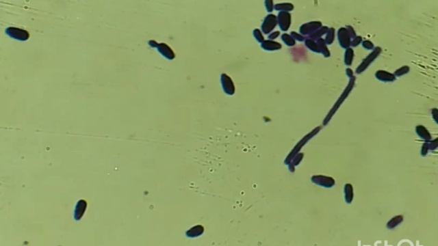 Levures, candida albicans après coloration. смотреть онлайн