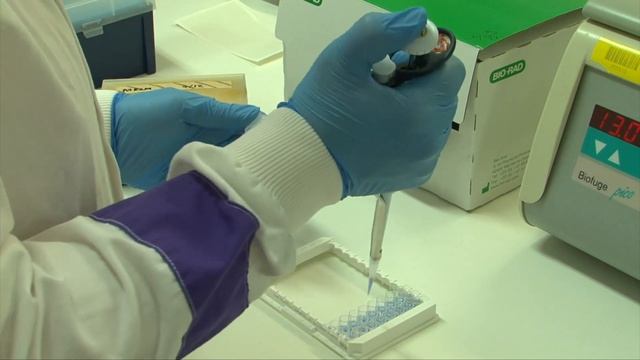 Galactomannan testing (Bio-Rad Platelia kit) смотреть онлайн