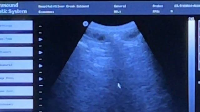 Ultrasounding To Confirm Pregnancy | Not Sure If She's Pregnant!! смотреть онлайн