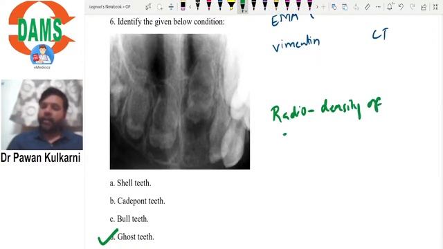 Super Revision Series | Oral Pathology || Dr. Pawan Kulkarni