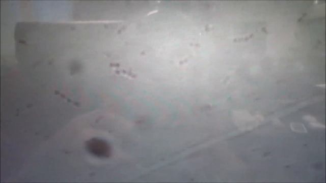 BIOL215 Microbiology Lab 1