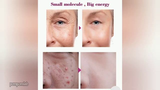RtopR Olive Peptide Firming Anti-wrinkle Cream ❤️❤️❤️ review | tagalog | pompomlab смотреть онлайн