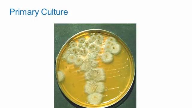 Dimorphic Fungi: Sporothrichosis [Hot Topic]