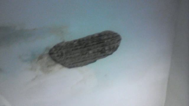 Течет крыша в травматологии в городе прохладном кбр