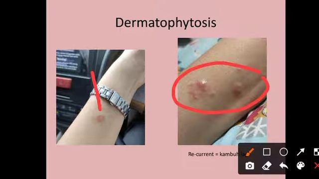 MIKOLOGI SMK смотреть онлайн