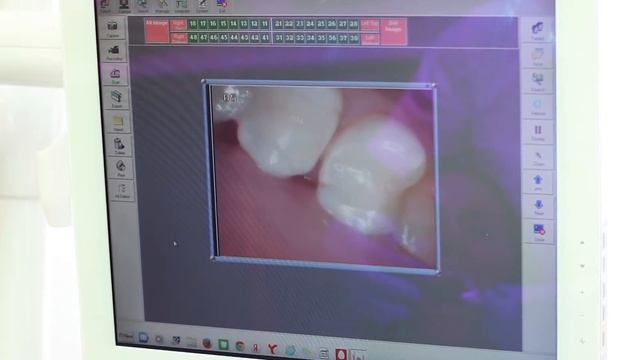Gruber stomatology смотреть онлайн
