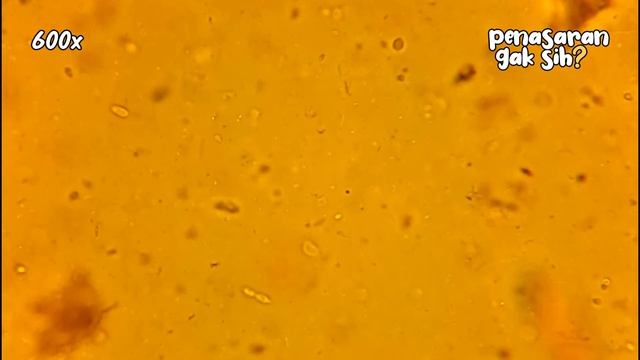 ZOOM 1000X: MIKROORGANISME Di KECAP | EKSPERIMEN MIKROSKOP
