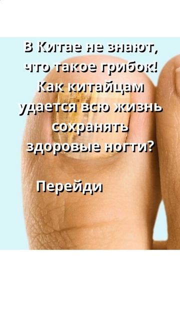 нога грибок