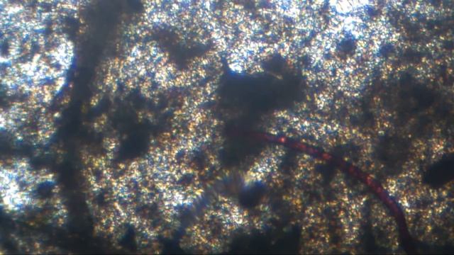 Morgellons смотреть онлайн