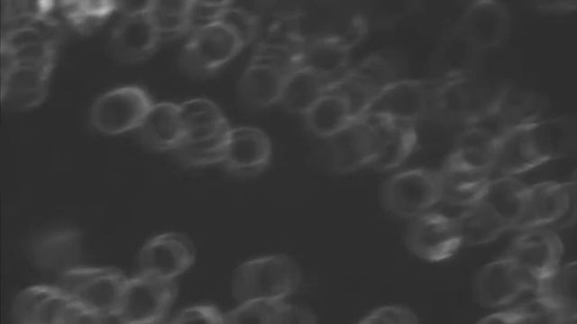 Mikroskopowy Obraz żywej Kropli Krwi W Ciemnym Polu Widzenia [Genetic Pro, Kamera X-5]