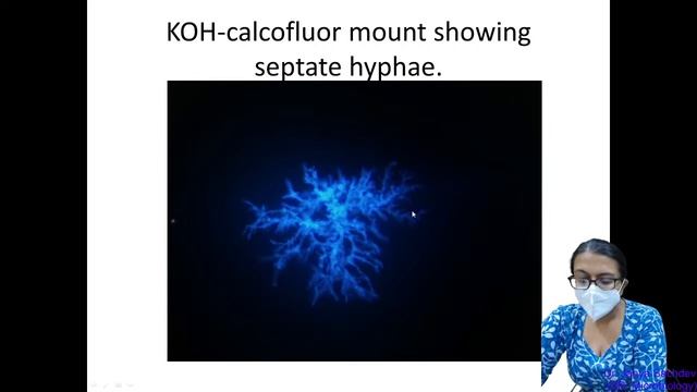 Laboratory Diagnosis Of Fungal Infections