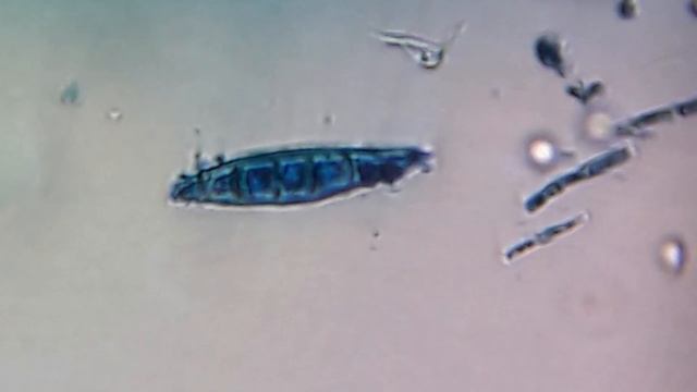 33 Micelio de fructificación Macroconidia смотреть онлайн