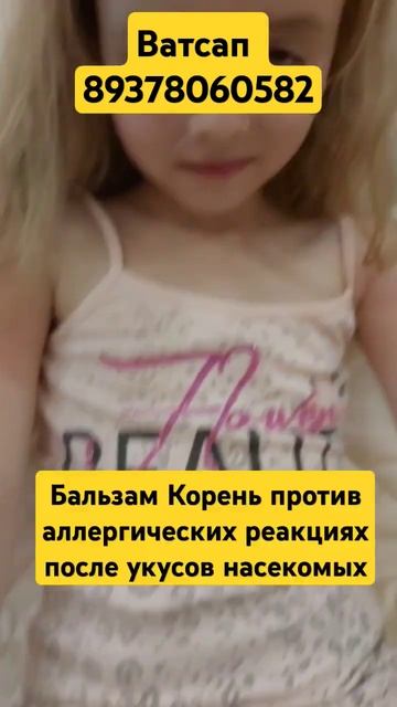 Эффективное средство после укусов мошек и комаров Сибирский бальзам Корень #siberianwellness смотреть онлайн
