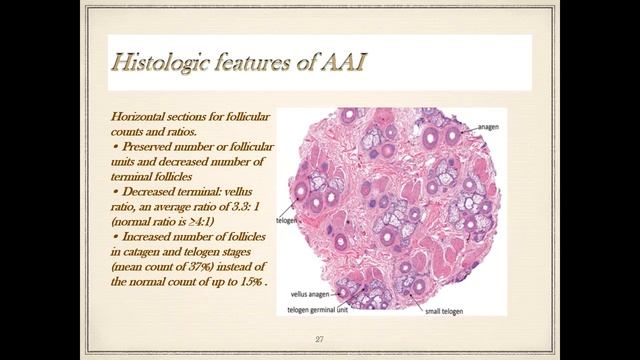 Pursue 26 X : Dermatopathology- ALOPECIA смотреть онлайн