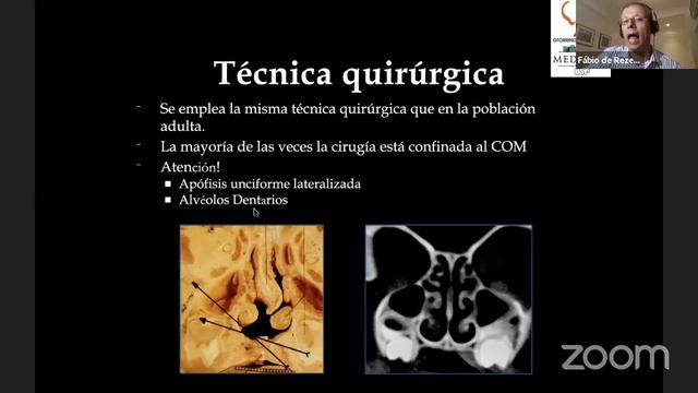 ENFERMEDADES NASO SINUSALES Y TÉCNICAS QUIRÚRGICAS ENDOSCÓPICAS смотреть онлайн