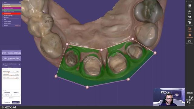 Exocad Model Creator 2021 WEBINAR - DentalCAD 3.0 Galway MODEL CREATOR (IT)
