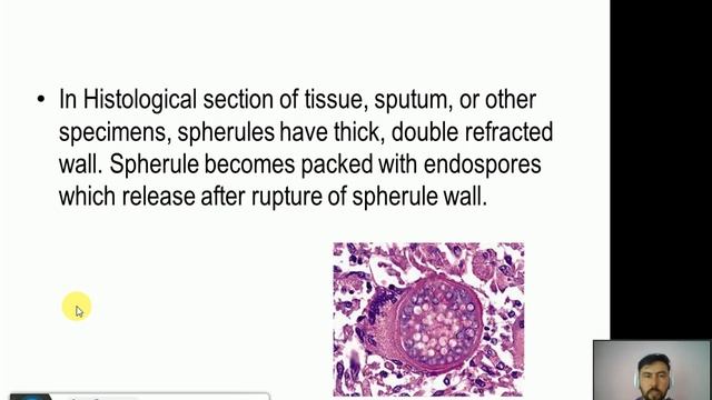 Medical Mycology Lecture 13 ( Systemic Mycoses- Coccidioidomycosis)