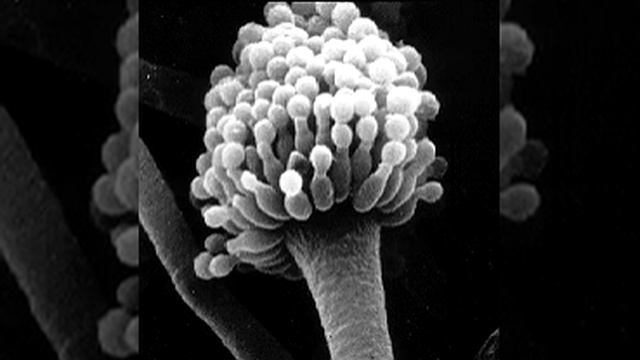 Fungi Imperfecti | Wikipedia Audio Article