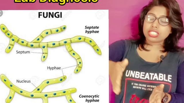 Aspergillosis Aspergillus Morphology Lab Diagnosis & Pathogenesis & Treatment