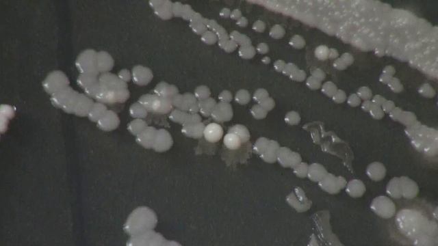 Capturing Wild Yeast Part III - Identifying Usable Yeasts смотреть онлайн