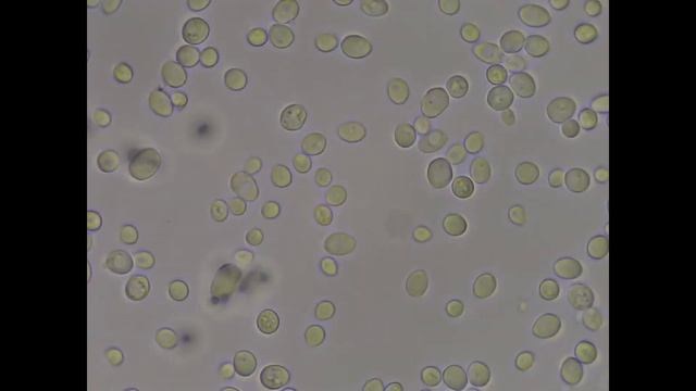Brownian Motion(Saccharomyces Cerevisiae)- Brown-mozgás Megfigyelése élesztő Sejteken