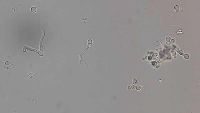 Germ tube of Candida albicans Demonstration смотреть онлайн