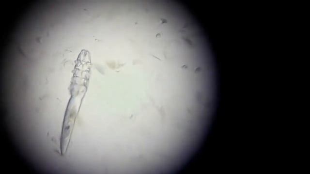 Demodex canis under the microscope - Veterinary Video смотреть онлайн