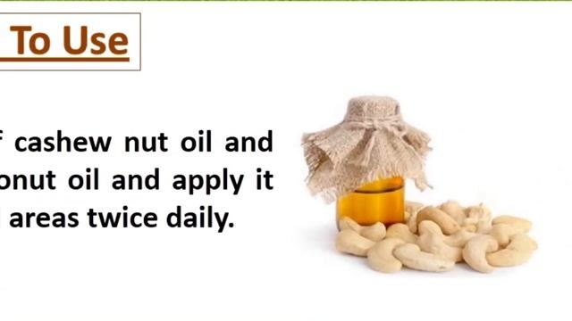 How To Get Rid Of Psoriasis Naturally