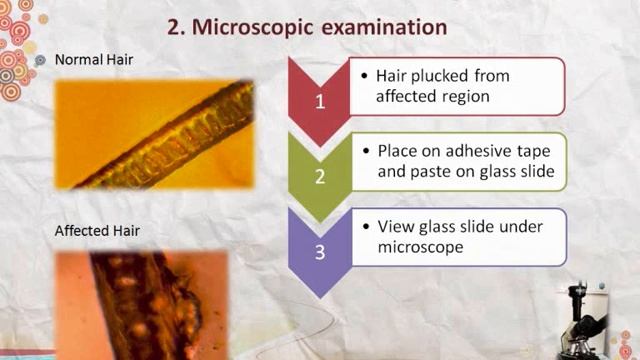Dermatophytosis - 4 methods of diagnosis смотреть онлайн