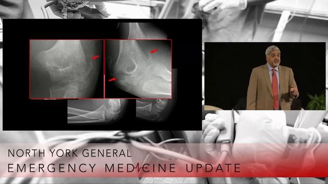 EMU 365 Series: Arun Sayal on evaluating pediatric elbow injuries смотреть онлайн