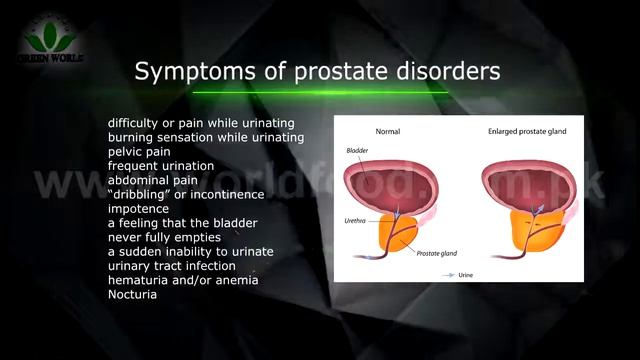 Prosta Sure Capsule Green World смотреть онлайн