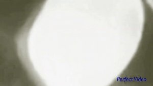 KlaskyKlaskyKlaskyKlasky Gummy Bear Short Version Effects 2(Sponsored by Sprite Cranberry Effects 2