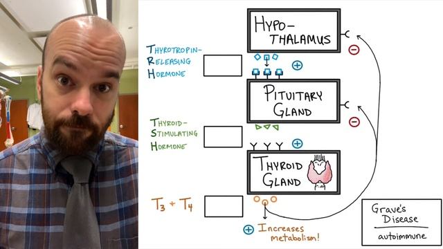 Diagnosing Disorders with HPT Axis - Pituitary and Thyroid Tumors, Graves’, Hashimoto’s, and Goiter смотреть онлайн
