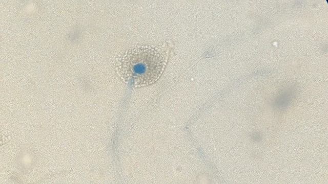 Mucor Species colony morphology on SDA and LPCB tease Mount Microscopy смотреть онлайн