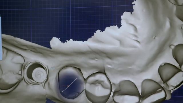 vhf R5 – Same-Day Dentistry in the White Clinic смотреть онлайн