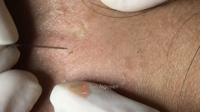 Satisfying and Relaxation with SURI NGUYEN Beauty Spa Video #207 смотреть онлайн