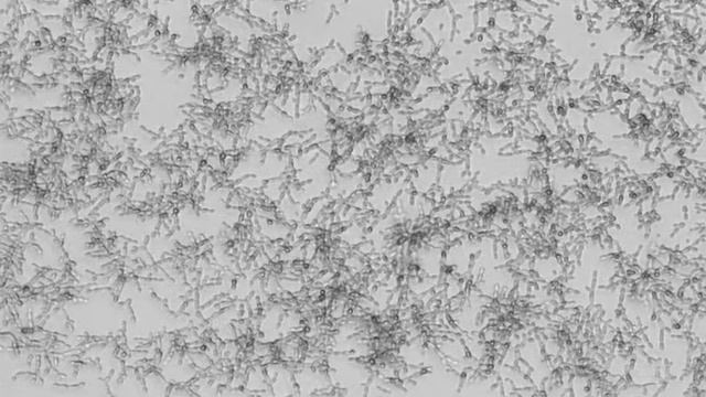 Candida albicans with a knockout of eSG1 смотреть онлайн