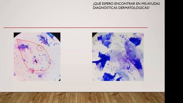 Ayudas Diagnosticas En Dermatologia