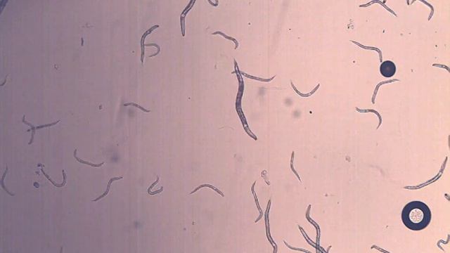 C. elegans rol-6 movement смотреть онлайн