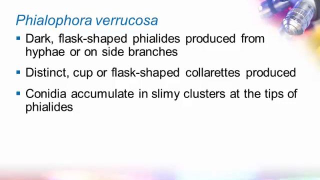 Identification of Melanized (Dermatitiaceous) Fungi Part 3 [Hot Topic] смотреть онлайн