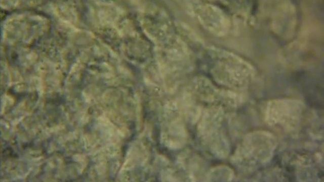 Bacteria from the human sinuses at 1000X. смотреть онлайн