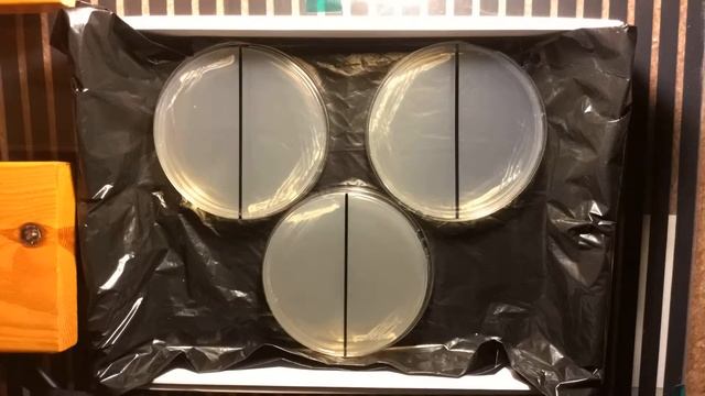 Saccharomyces cerevisiae time lapse. смотреть онлайн