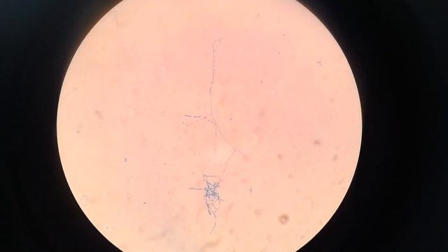 Dermatophyte смотреть онлайн