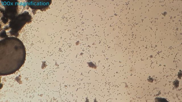 Moldy Fruit under the Microscope - Penicillium Fungi смотреть онлайн