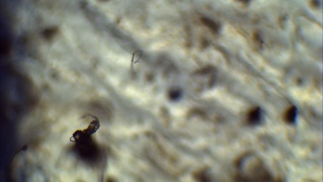 How do I know if I have Demodex mites? Part 5 смотреть онлайн